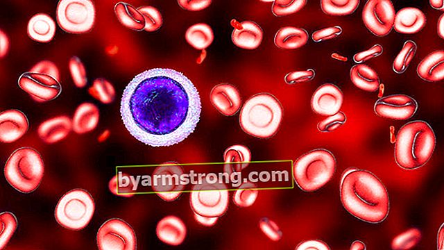 Cosa causa l'anemia mediterranea? Quali sono le cause dell'anemia mediterranea? - Come viene trattata l'anemia mediterranea?