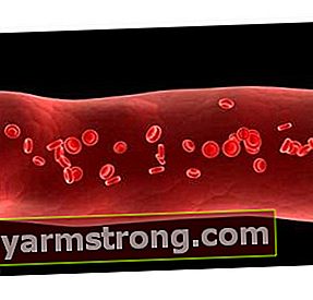 血漿とは何ですか？