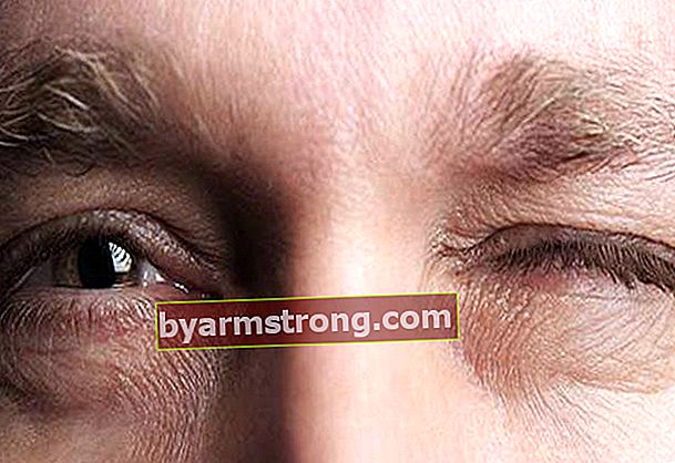 สาเหตุของตาขวาและซ้ายกระตุก - ทำให้ตากระตุกทำไมตากระตุก?