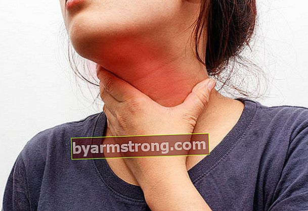 Cos'è l'infiammazione delle corde vocali (groppa)?