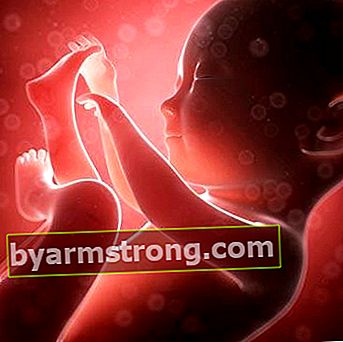 Bambini con febbre uterina: gravidanza ectopica