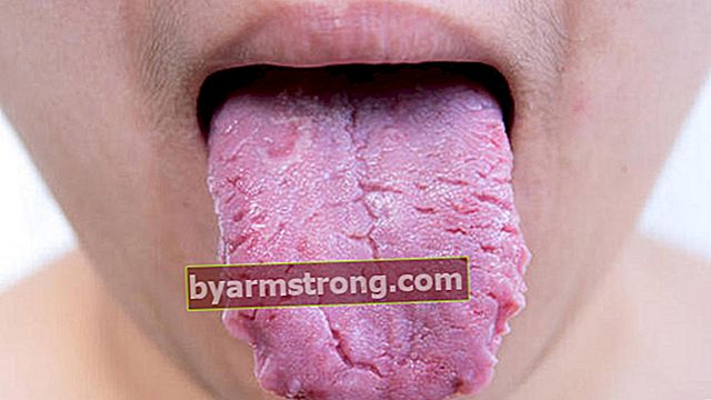 혀 상처의 원인은 무엇입니까? 혀 상처는 어떻게 되나요? -혀 상처 치료